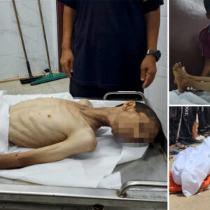 gazzede yetersiz beslenme nedeniyle 30 yasindaki filistinli hayatini kaybetti cbmmVhRc